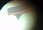 2000e-lll Empire Stereo Cartridge And